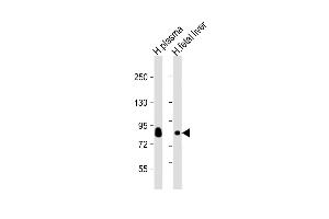 All lanes : Anti-Transferrin Antibody at 1:2000 dilution Lane 1: human plasma lysate Lane 2: human fetal liver lysate Lysates/proteins at 20 μg per lane. (Transferrin antibody  (AA 101-135))