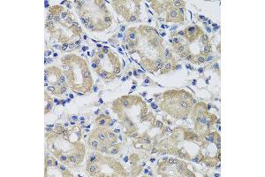 Immunohistochemistry of paraffin-embedded human gastric using ST8SIA2 antibody at dilution of 1:100 (x40 lens). (ST8SIA2 antibody)