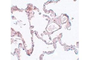 Immunohistochemical staining of hman lung tissue with PLEKHM1 polyclonal antibody  at 5 ug/mL dilution. (PLEKHM1 antibody  (N-Term))