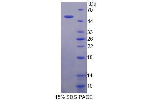 SDS-PAGE analysis of Mouse NCOA6 Protein. (NCOA6 Protein)