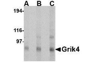 Image no. 1 for anti-Glutamate Receptor, Ionotropic, Kainate 4 (GRIK4) (N-Term) antibody (ABIN1494379) (GRIK4 antibody  (N-Term))