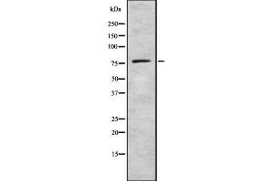 Western blot analysis GCS alpha-1 using LOVO whole cell lysates (GUCY1A1 antibody  (C-Term))