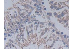 Detection of MUC20 in Rat Testis Tissue using Polyclonal Antibody to Mucin 20 (MUC20) (MUC20 antibody  (AA 113-347))