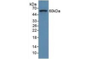 Detection of COL8a1 in Human Hela Cells using Polyclonal Antibody to Collagen Type VIII Alpha 1 (COL8a1) (COL8A1 antibody  (AA 590-744))
