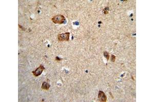 IHC analysis of FFPE human brain tissue stained with Integrin alpha 1 antibody (Integrin alpha 1 antibody  (AA 727-755))