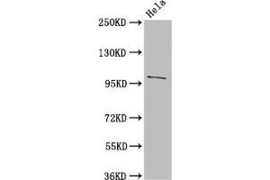 Western Blot Positive WB detected in: Hela whole cell lysate All lanes: NPC1 antibody at 3 μg/mL Secondary Goat polyclonal to rabbit IgG at 1/50000 dilution Predicted band size: 143, 108 kDa Observed band size: 108 kDa (NPC1 antibody  (AA 23-269))