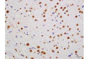 KLHL7 antibody  (AA 51-150)