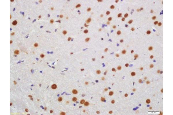 KLHL7 antibody  (AA 51-150)