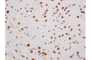 Formalin-fixed and paraffin embedded rat brain labeled with Rabbit Anti-KLHL7 Polyclonal Antibody, Unconjugated (ABIN760046) at 1:200 followed by conjugation to the secondary antibody and DAB staining