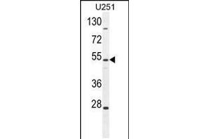 Western blot analysis in U251 cell line lysates (35ug/lane). (ZIK1 antibody  (AA 186-215))