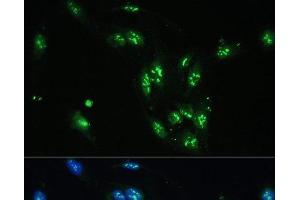 Immunofluorescence analysis of U-2 OS cells using CCDC59 Polyclonal Antibody at dilution of 1:100. (CCDC59 antibody)
