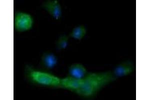 Image no. 5 for anti-Melan A (MLANA) antibody (ABIN1499424)