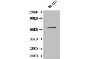Western Blot Positive WB detected in: Mouse brain tissue All lanes: ICA1 antibody at 4 μg/mL Secondary Goat polyclonal to rabbit IgG at 1/50000 dilution Predicted band size: 55, 58 kDa Observed band size: 55 kDa