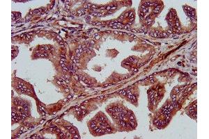 IHC image of ABIN7150310 diluted at 1:400 and staining in paraffin-embedded human prostate tissue performed on a Leica BondTM system. (GINS1 antibody  (AA 1-196))
