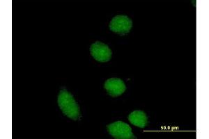 Immunofluorescence of purified MaxPab antibody to CBFA2T2 on HeLa cell.
