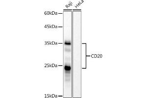Western blot analysis of extracts of Raji cells, using CD20 antibody (ABIN7268472) at 1:1000 dilution. (CD20 antibody)