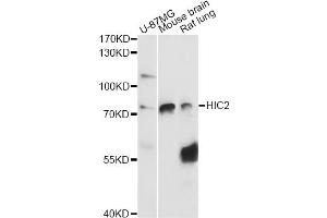 Western blot analysis of extracts of various cell lines, using HIC2 antibody (ABIN6291160) at 1:3000 dilution. (HIC2 antibody)