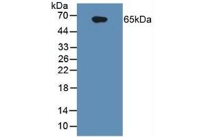 Detection of IL1R1 in Human Raji Cells using Polyclonal Antibody to Interleukin 1 Receptor Type I (IL1R1) (IL1R1 antibody  (AA 21-109))