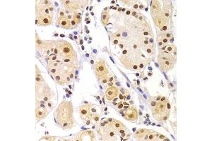 Immunohistochemistry of paraffin-embedded human gastric injury using HNRNPA1 Antibody (ABIN5975570) at dilution of 1/100 (40x lens). (HNRNPA1 antibody)