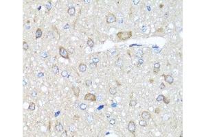 Immunohistochemistry of paraffin-embedded Rat brain using PRKAG1 Polyclonal Antibody at dilution of 1:100 (40x lens). (PRKAG1 antibody)