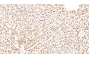 Detection of C5a in Rat Liver Tissue using Polyclonal Antibody to Complement Component 5a (C5a) (C5A antibody  (AA 1-77))