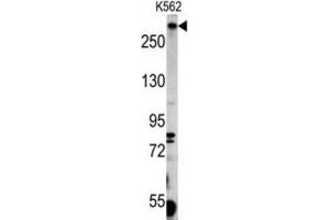 Western Blotting (WB) image for anti-Pericentriolar Material 1 (PCM1) antibody (ABIN3003241)