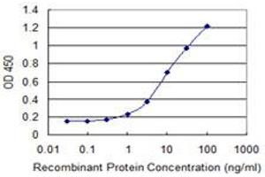 Detection limit for recombinant GST tagged SAMD4A is 0. (SAMD4A antibody  (AA 161-270))