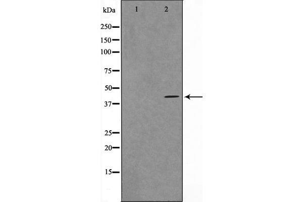 VPS72 antibody  (Internal Region)