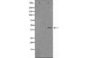Western blot analysis on RAW264. (VPS72 antibody  (Internal Region))