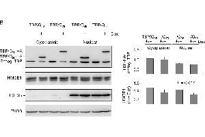ROS and HMGB1 distribution in TBP/Q36~79 293 cells. (Histone H3.3B antibody  (full length))