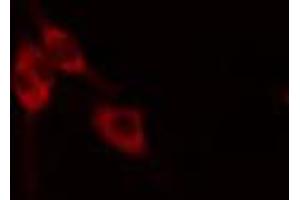 ABIN6268882 staining HeLa cells by IF/ICC. (Fibronectin 1 antibody  (C-Term))