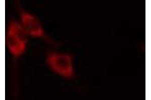 ABIN6268882 staining HeLa cells by IF/ICC. (Fibronectin 1 antibody  (C-Term))