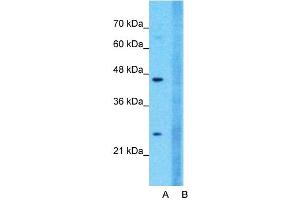 Host:  Rabbit  Target Name:  CLDN18  Sample Type:  Jurkat  Lane A:  Primary Antibody  Lane B:  Primary Antibody + Blocking Peptide  Primary Antibody Concentration:  1ug/ml  Peptide Concentration:  5ug/ml  Lysate Quantity:  25ug/lane/lane  Gel Concentration:  0.