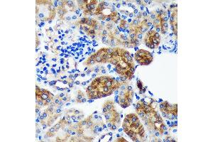 Immunohistochemistry of paraffin-embedded Mouse kidney using PYCR2 Rabbit pAb (ABIN7269766) at dilution of 1:100 (40x lens).