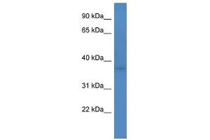 Western Blot showing Fank1 antibody used at a concentration of 1-2 ug/ml to detect its target protein. (FANK1 antibody  (Middle Region))