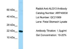 WB Suggested Anti-ALG13 Antibody   Titration: 1. (ALG13 antibody  (N-Term))