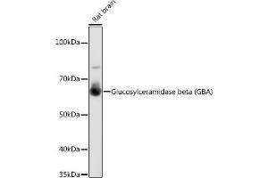 Western blot analysis of extracts of Rat brain, using Glucosylceramidase beta (Glucosylceramidase beta (GBA)) antibody (ABIN7267407) at 1:1000 dilution. (GBA antibody)