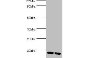Western blot All lanes: Peptidyl-prolyl cis-trans isomerase FKBP2 antibody at 10 μg/mL Lane 1: Mouse thymus tissue Lane 2: Rat brain tissue Secondary Goat polyclonal to rabbit IgG at 1/10000 dilution Predicted band size: 16 kDa Observed band size: 16 kDa (FKBP2 antibody  (AA 22-142))