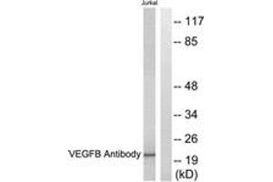 Western blot analysis of extracts from Jurkat cells, using VEGFB Antibody. (VEGFB antibody  (AA 91-140))