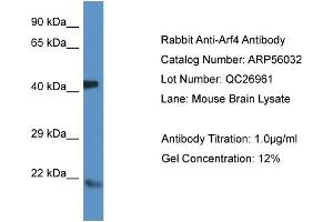 Western Blotting (WB) image for anti-ADP-Ribosylation Factor 4 (ARF4) (N-Term) antibody (ABIN785783) (ARF4 antibody  (N-Term))