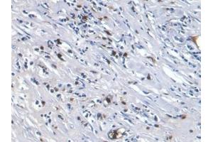 Detection of S100A8 in Human Lymph node Tissue using Monoclonal Antibody to S100 Calcium Binding Protein A8 (S100A8) (S100A8 antibody  (AA 1-93))