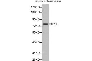 Western Blotting (WB) image for anti-Myxovirus Resistance Protein 1 (MX1) (AA 368-662) antibody (ABIN6218886) (MX1 antibody  (AA 368-662))