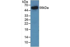 Detection of Recombinant AGT, Rat using Monoclonal Antibody to Angiotensinogen (AGT) (AGT antibody  (AA 25-477))