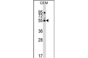 PALMD 抗体  (N-Term)