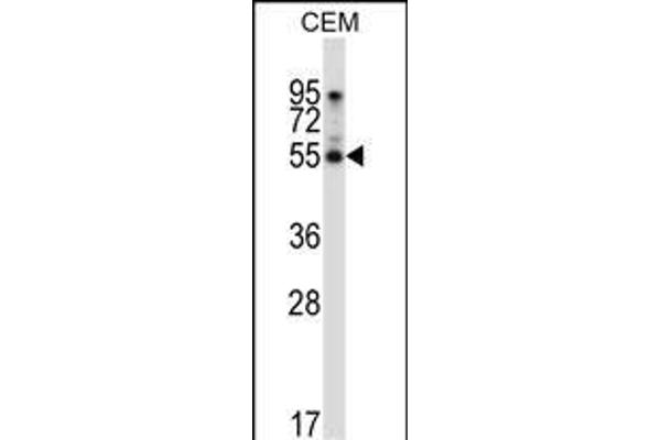 PALMD antibody  (N-Term)