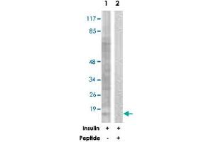 Western blot analysis of extracts from Jurkat cells, treated with Insulin (0. (eIF4EBP1 antibody)
