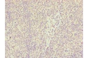 Immunohistochemistry of paraffin-embedded human tonsil tissue using ABIN7156903 at dilution of 1:100 (IL36A/IL1F6 antibody  (AA 1-158))