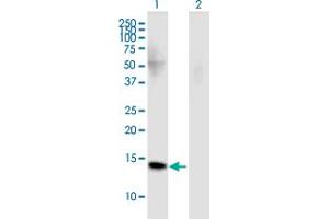 Western Blot analysis of FMN2 expression in transfected 293T cell line by FMN2 monoclonal antibody (M02), clone 4B8. (Formin 2 antibody  (AA 144-243))