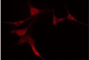 ABIN6274200 staining COLO205 cells by IF/ICC. (PRKACG antibody)
