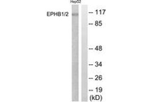 Western blot analysis of extracts from HepG2 cells, using EPHB1/2 (Ab-594/604) Antibody. (EPHB1/2 antibody  (AA 561-610))